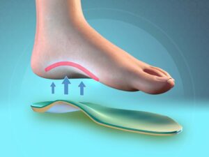 Heel Spurs:  What are they and what can I do to get rid of them?